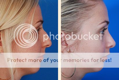 plastic surgeon beverly hills (c) Jhmfacs04 beverly hills md dark spot corrector